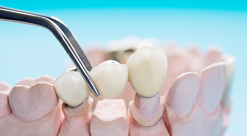 Treatment Banner thumb : Welling Dental