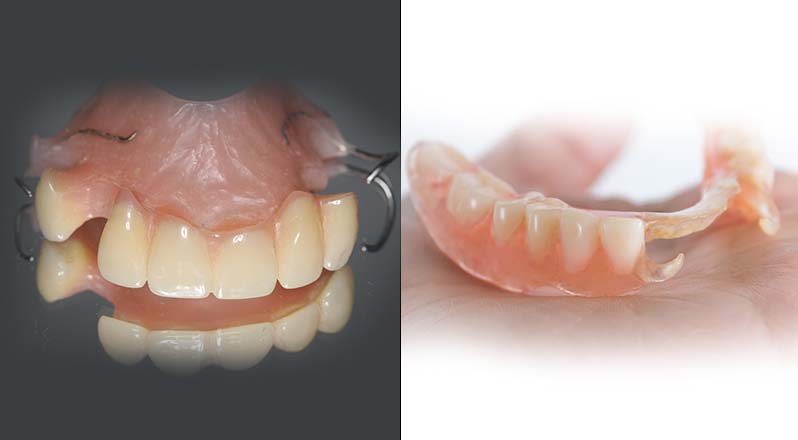 Treatment Banner thumb : Welling Dental