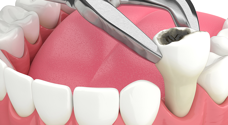 Treatment Banner thumb : Welling Dental