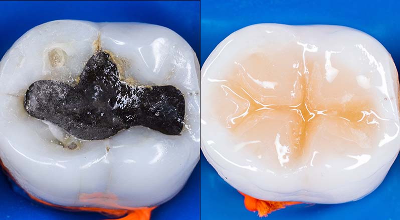 Treatment Banner thumb : Welling Dental