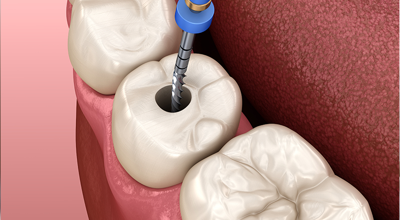 Treatment Banner thumb : Welling Dental