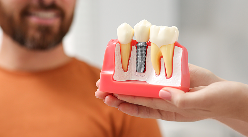 Treatment Banner thumb : Welling Dental